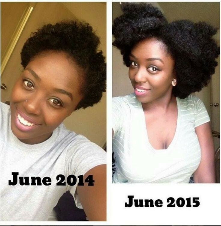 Hair Loss Treatment Butter Cream - 16 Organic Oils