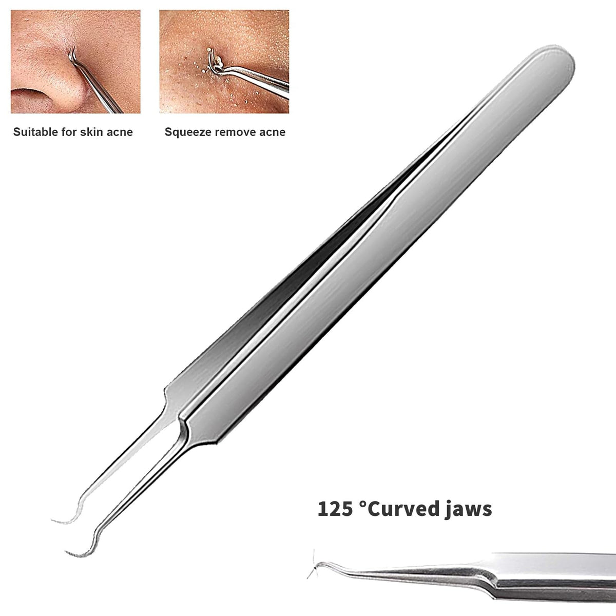 Blackhead Tweezers Set - 3 Stainless Steel Comedone Extractors for Acne & Pores