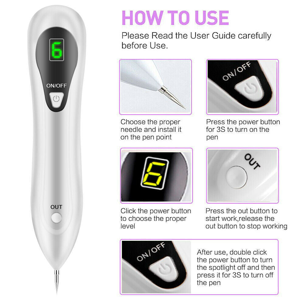 Home Use Laser Mole & Skin Tag Remover Pen - Dark Spot & Tattoo Removal