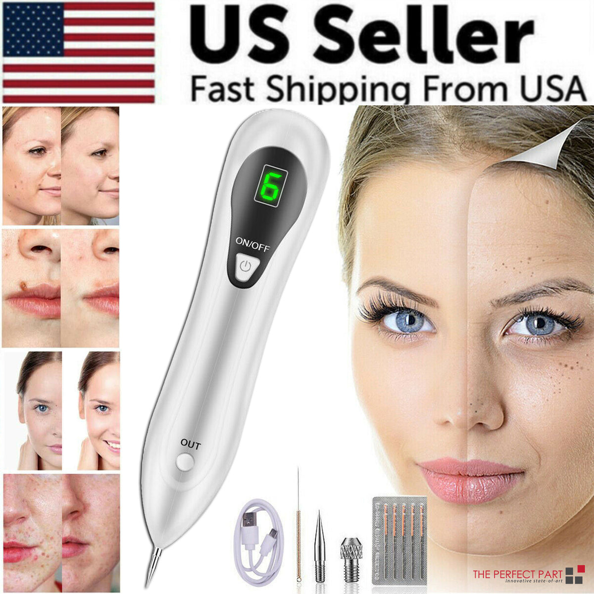 Laser Mole & Skin Tag Removal Pen - Dark Spot & Wart Remover, Rechargeable