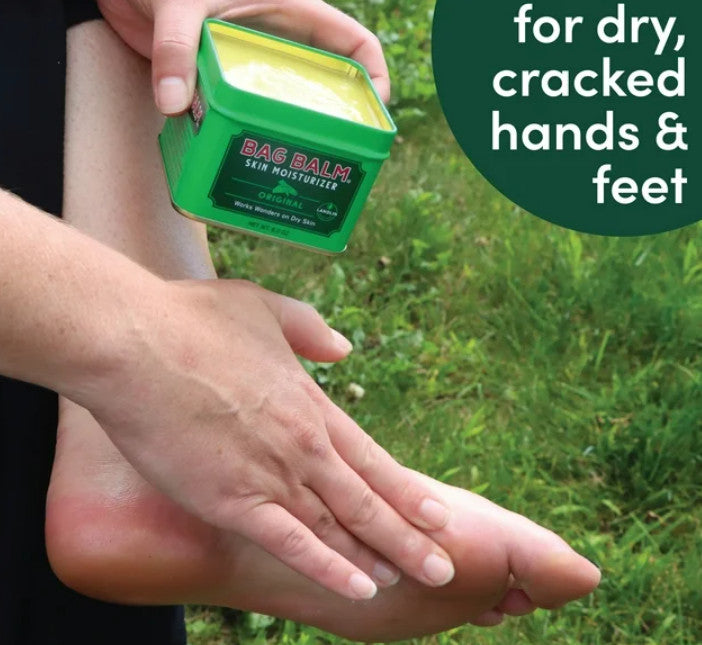 Vermont’s Original Bag Balm, Skin Moisturizer for Dry Skin, 8oz Tin