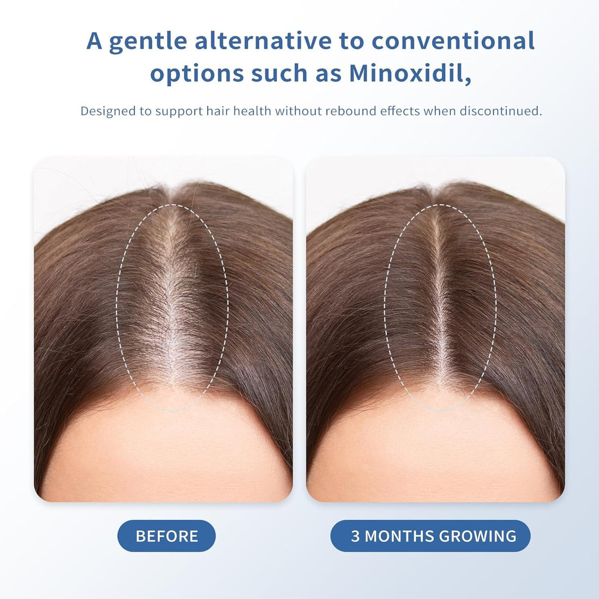 Hair Growth Serum, Biotin, Roll-On, Thinning Treatment, 30ml,