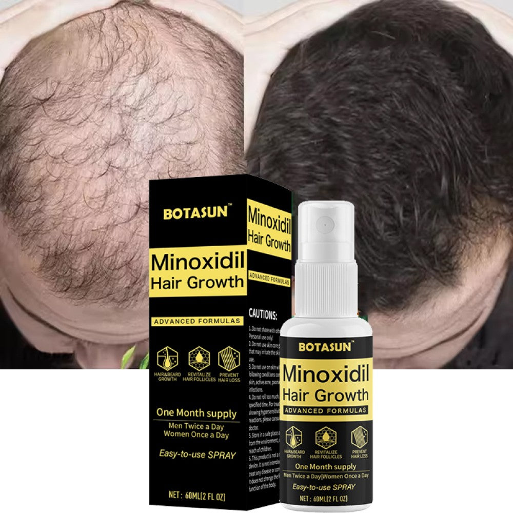Minoxidil 5% Spray Men Hair Regrowth Treatment Solution 1 Month