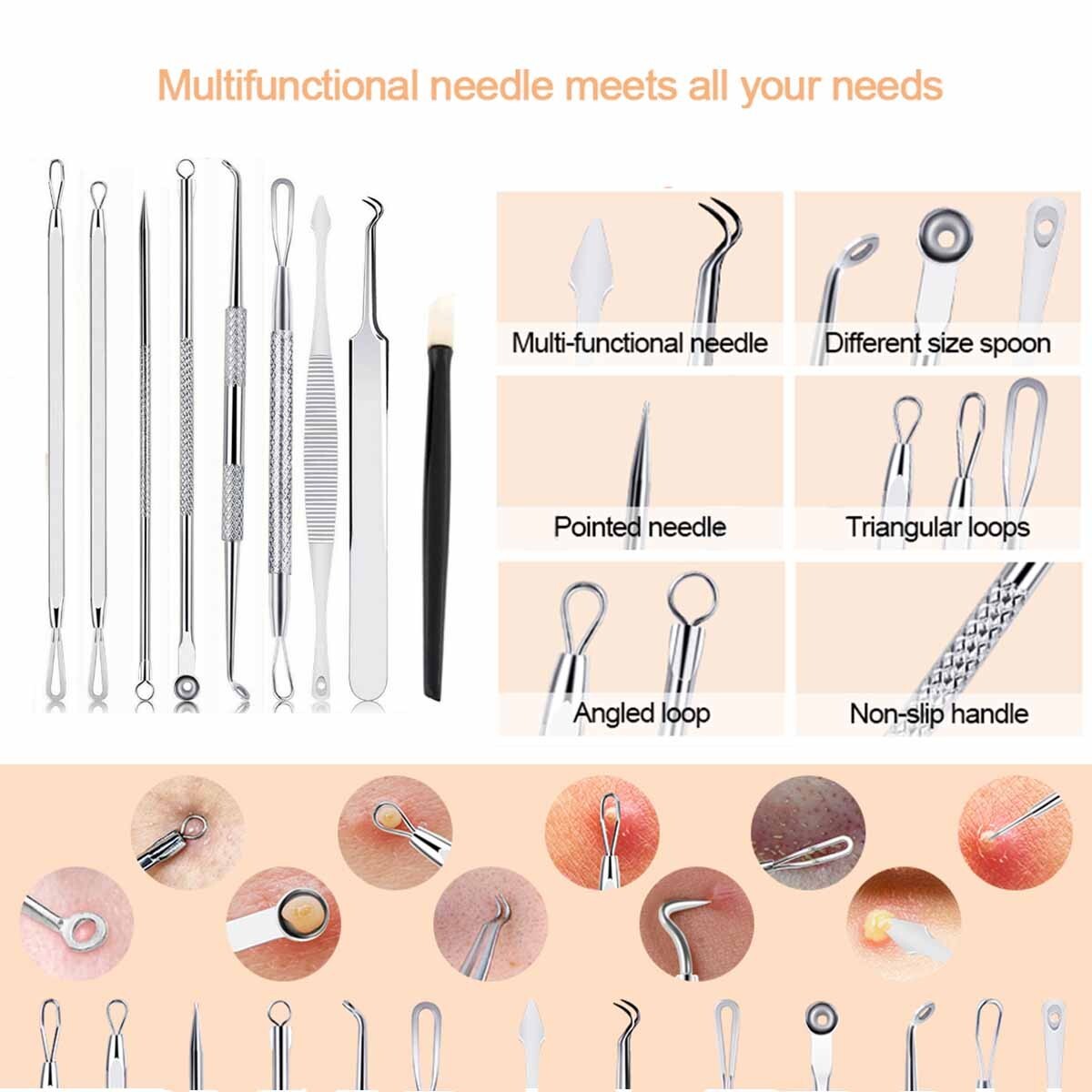 Blackhead Remover Tool Kit with 16 Extraction Heads - Pimple & Acne Spot Tool