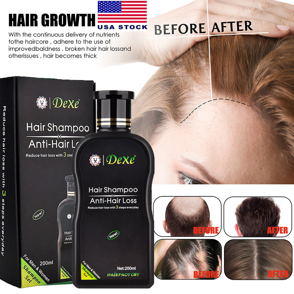 Anti-Hair Loss Shampoo for Men and Women | Herbal 200 ml Daily Cleanse