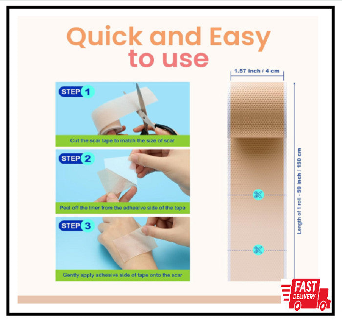 Silicone Scar Tape for Keloids & Wrinkles - Skin Color 1.6x60 Inches