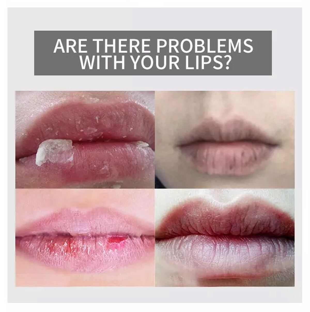 Moisturizing Strawberry Lip Balm for Very Dry Chapped Lips 50g