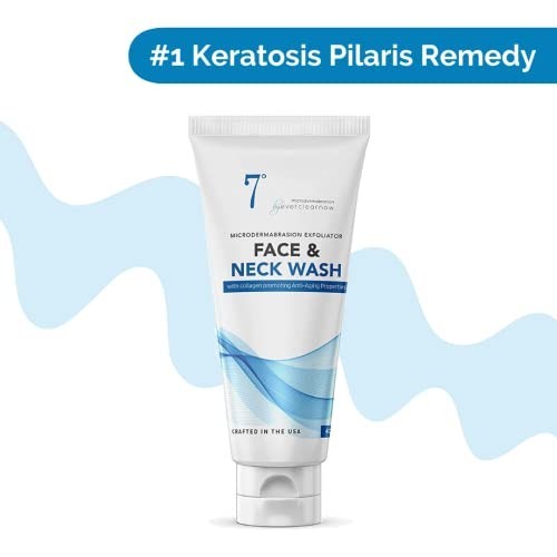 Aloe Vera Microdermabrasion Cream - Exfoliating Scrub for Acne & KP,