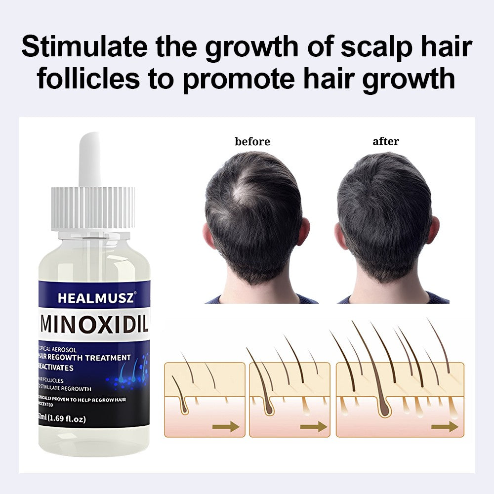Minoxidil 5% Hair Regrowth Solution for Men & Women