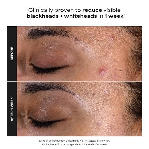 NEW Paula's Choice Skin Perfecting 2% BHA Liquid Exfoliant 118ml