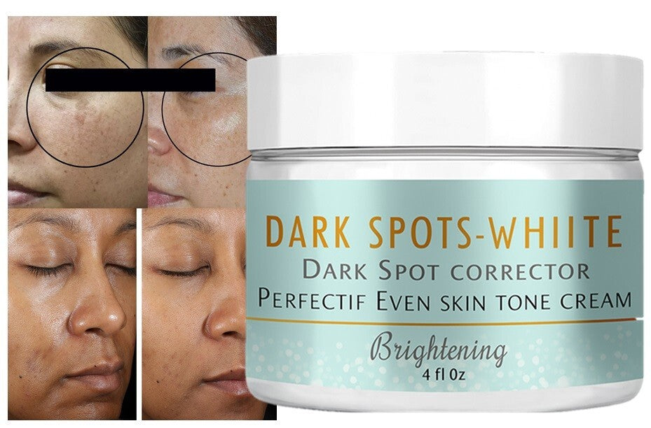Dark Spots Corrector Hand & Face Support Cream - Natural Skin Support 4oz