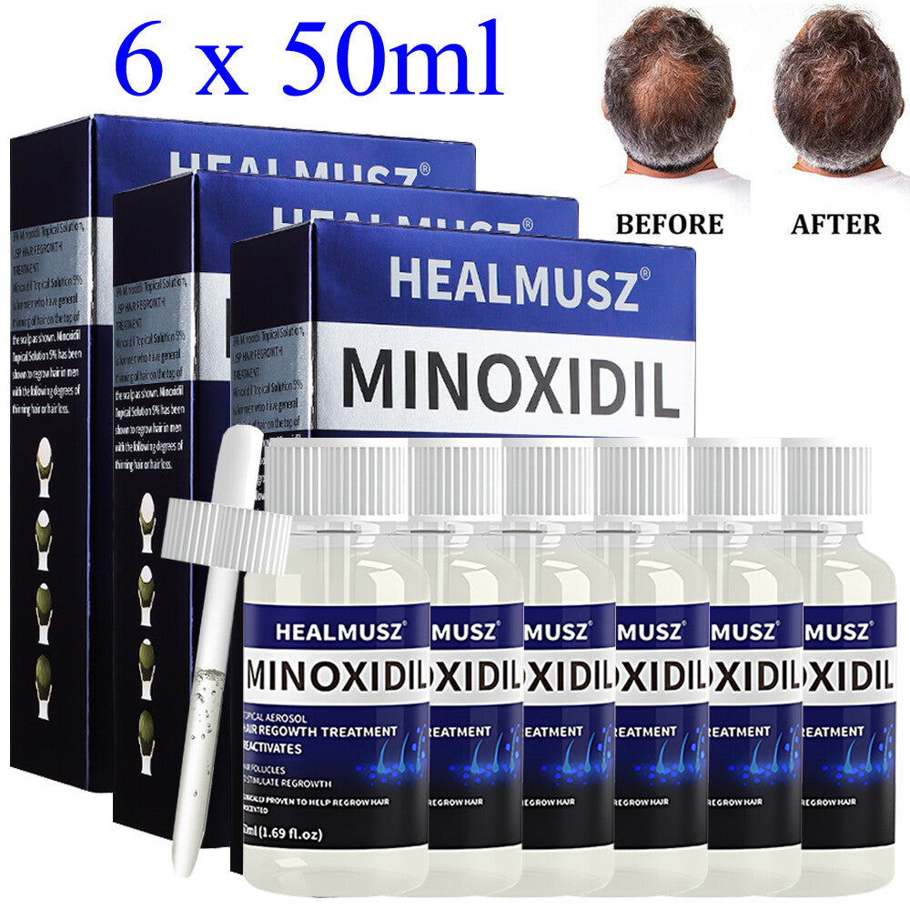Minoxidil 5% Hair Regrowth Treatment for Men - 6 Pack (300ml)