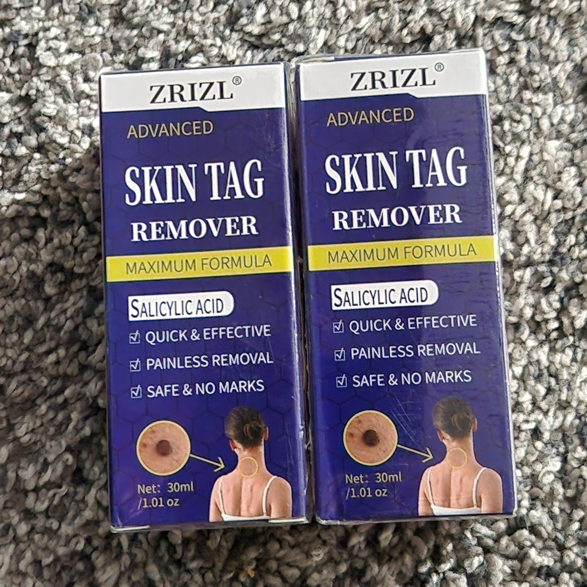 Skin Tag Remover Set - 2 Sealed Boxes for Safe Removal, Exp. 09/2027