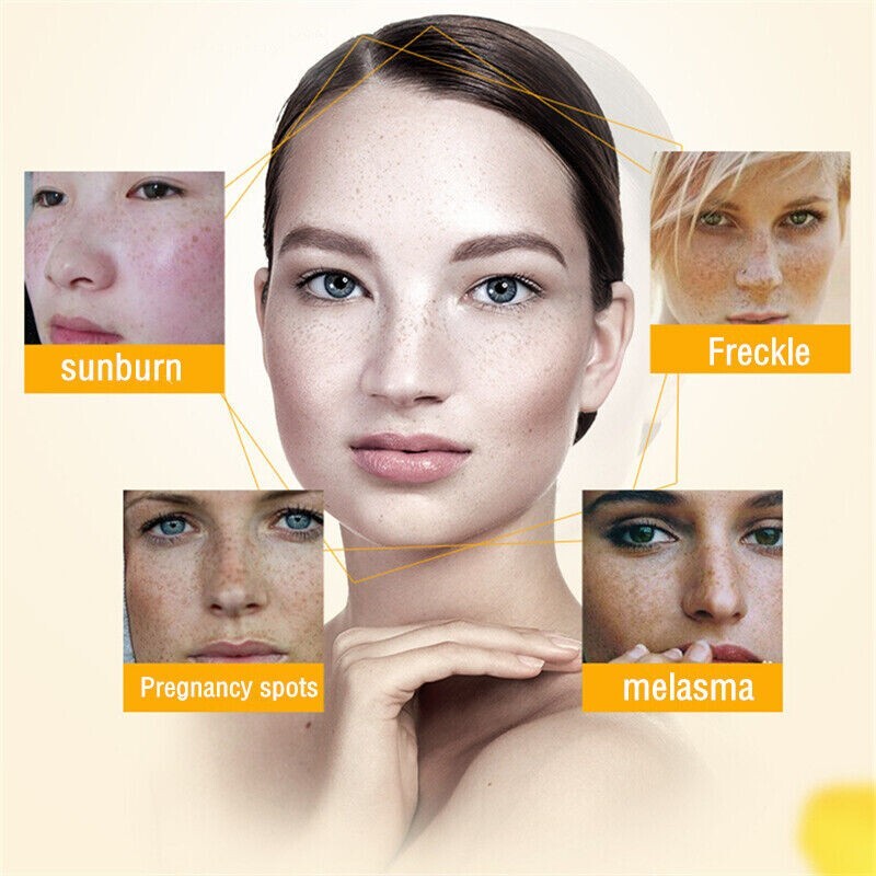 Kojic Acid Powder for Skin Whitening - 50g Pure 99% Face Care & Spot Removal