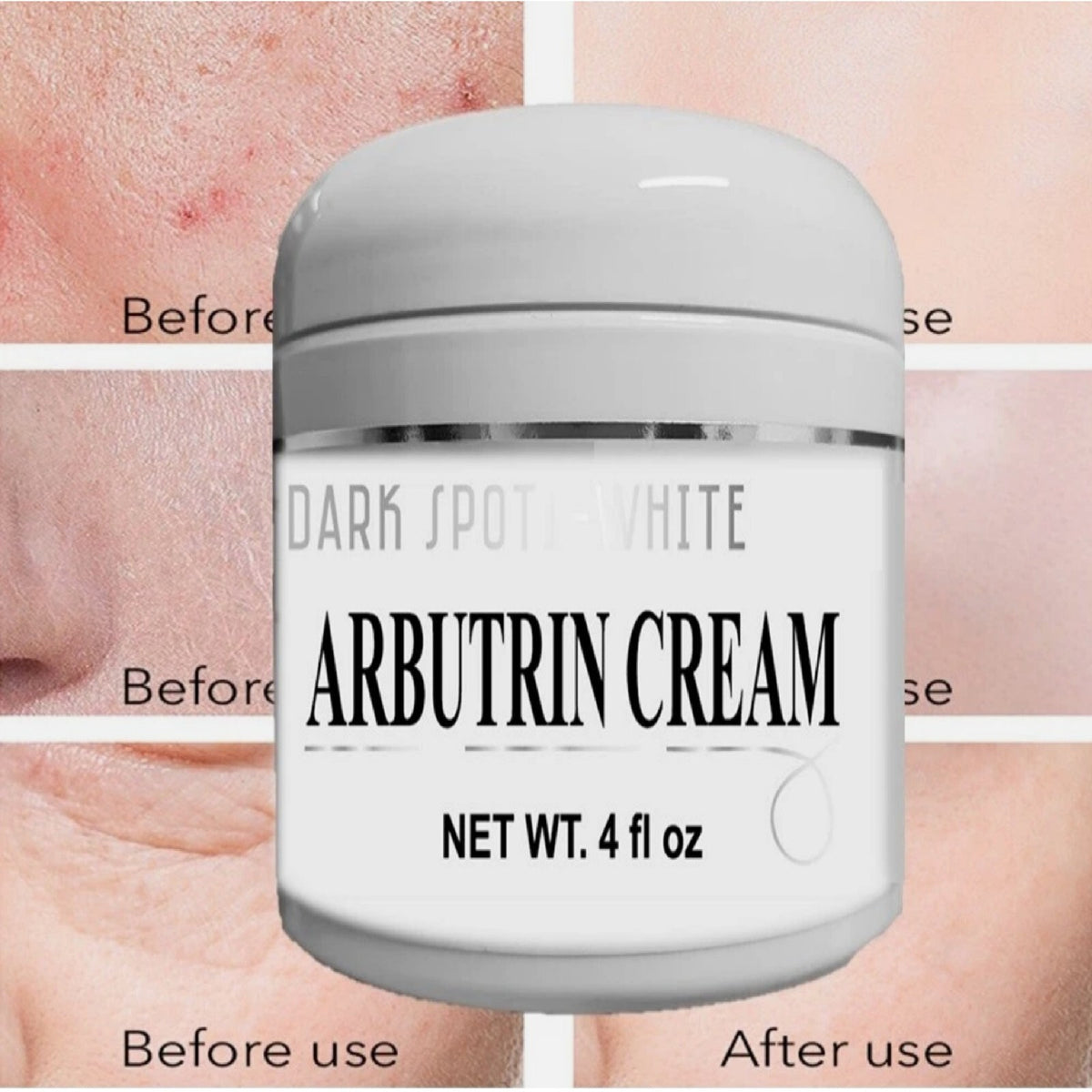 Dark Spot Correcting Face Cream - Evens Skin Tone & Smooths - 4 oz