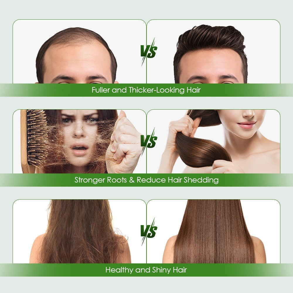 Hair Regrowth Serum System with Microneedling Roller – Men & Women