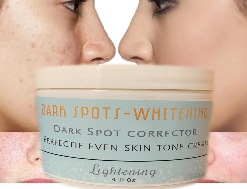 Dark Spot Corrector Cream for Face - Even Tone Skin Support & Brightening