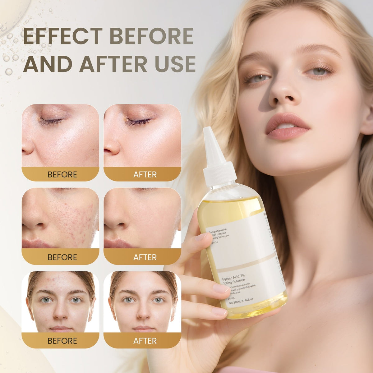 Glycolic Acid 7% Toner for Face Exfoliating Skin Resurfacing 240ml - Acne & Pore Care