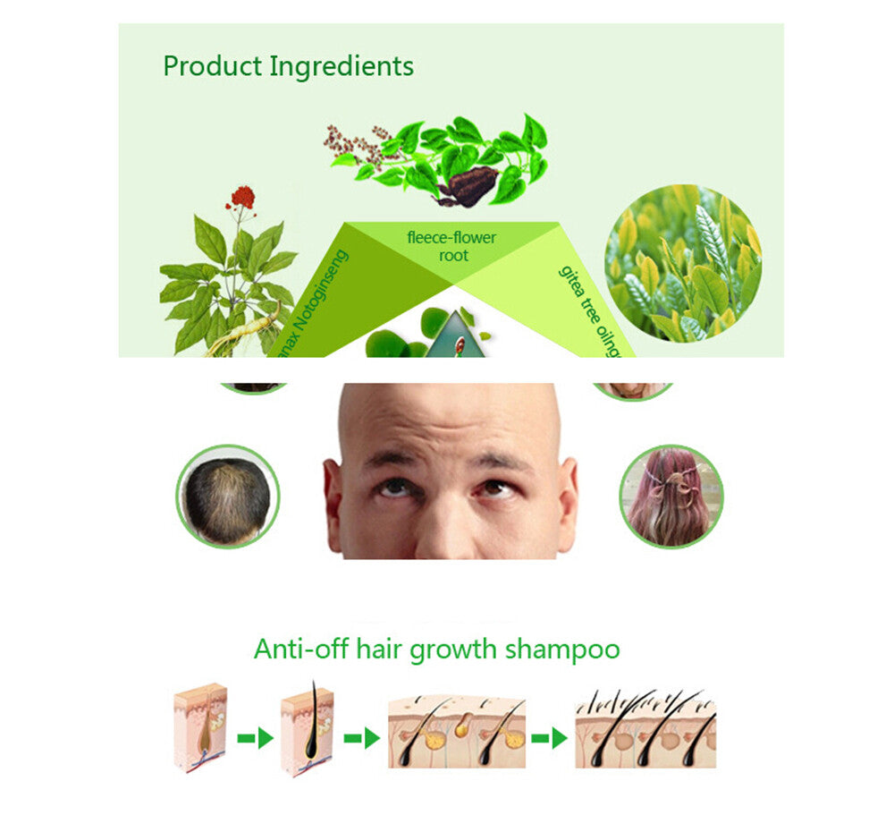 Anti-Hair Loss Shampoo for Men & Women - 200ml