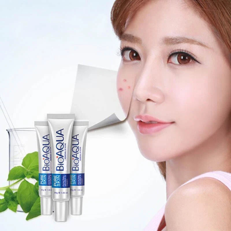 Acne Treatment Cream for Blemishes & Spots - 30ml Face Skin Care