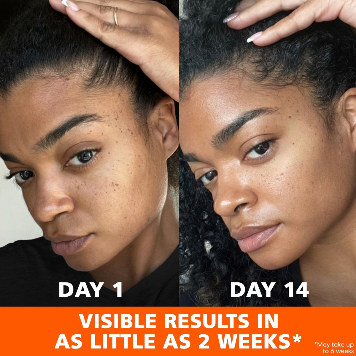 Anti-Dark Spot Fade Cream with Vitamin E & Niacinamide - 2.7 oz