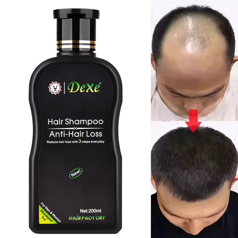 Anti Hair Loss Shampoo - 200ml Herbal Regrowth Treatment