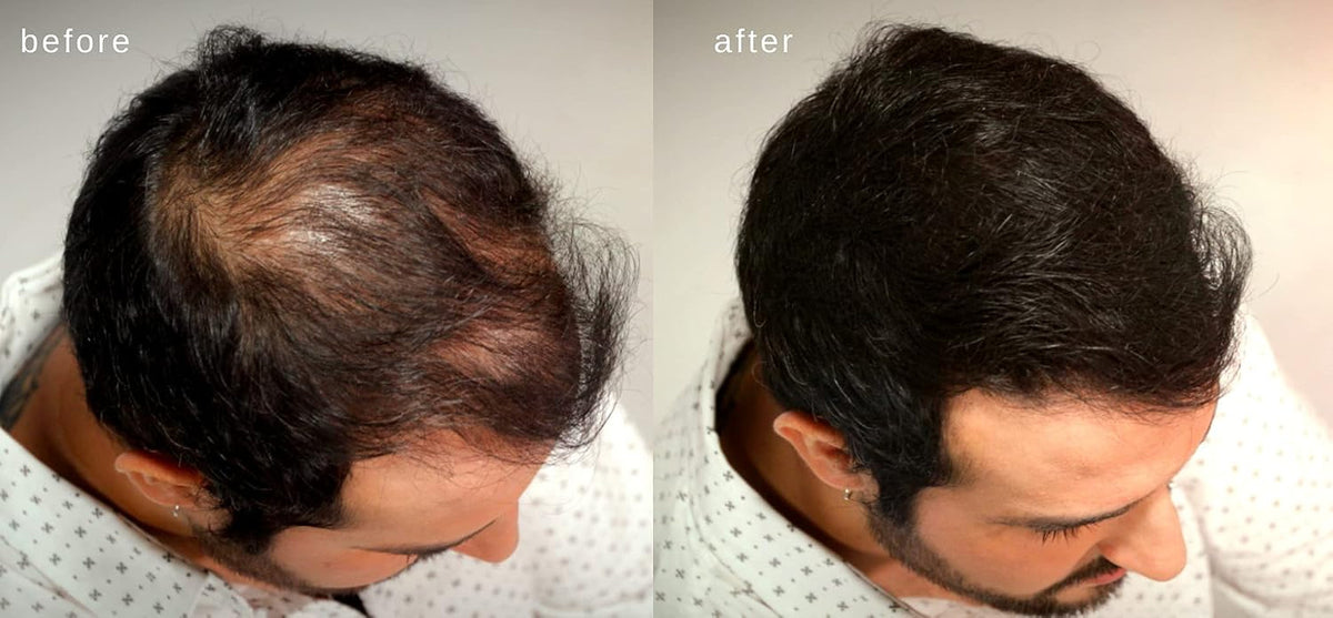 Hair Building Fibers, Volumizing Keratin Thinning Hair, Loss