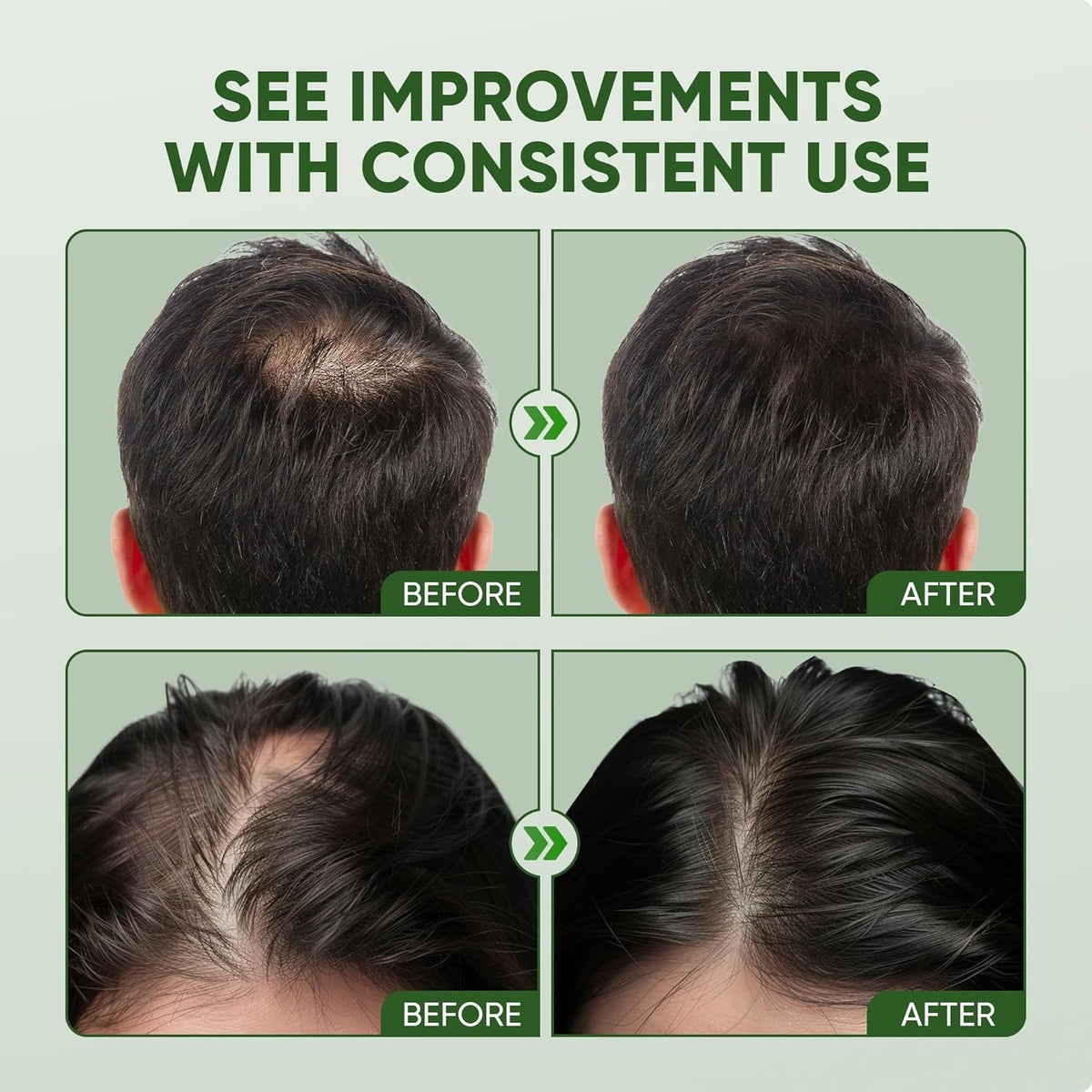 Natural Hair Growth Solution - Copper Peptide & Oils for Thicker 3.38