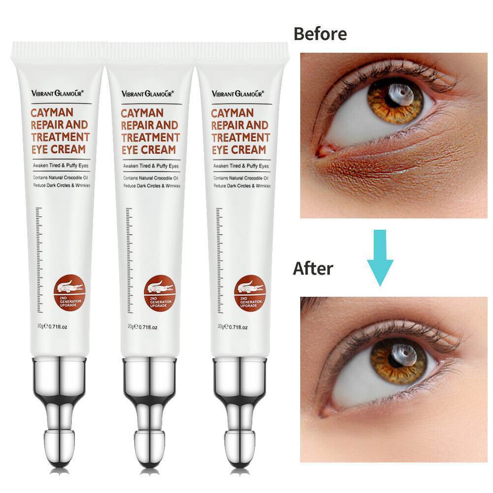 3PCS Eye Cream for Dark Circles & Wrinkles - Firming, Depuffing & Moisturizing