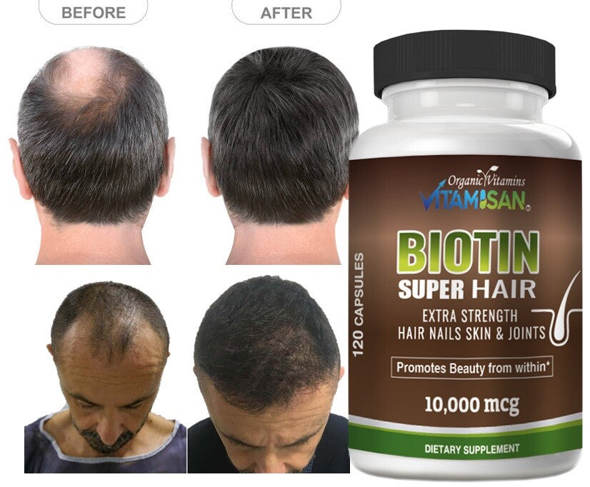 Biotin 10000 mcg Hair, Skin & Nail Vitamins with Keratin – 120 Capsules