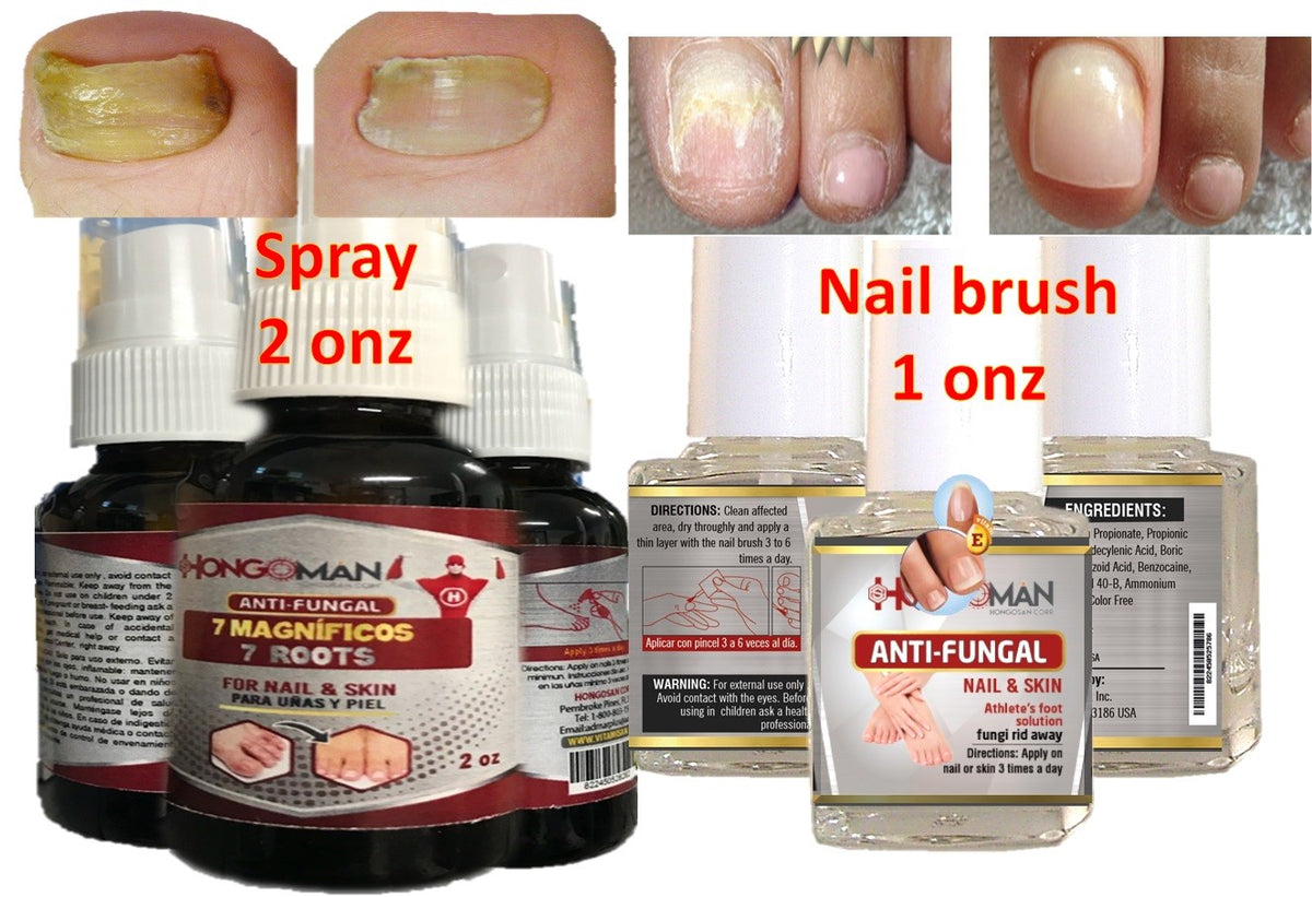 Natural Anti-Fungal Nail Support Kit for Fungus Clear Nails 2oz Spray & Brush