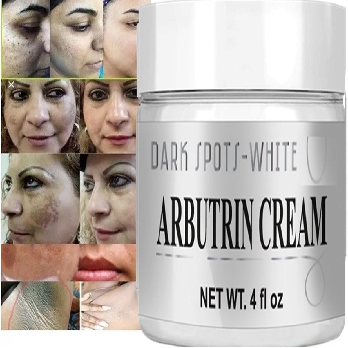 Arbutrin Radiance Cream for Dark Spots & Uneven Skin Tone - Daily Moisturizer
