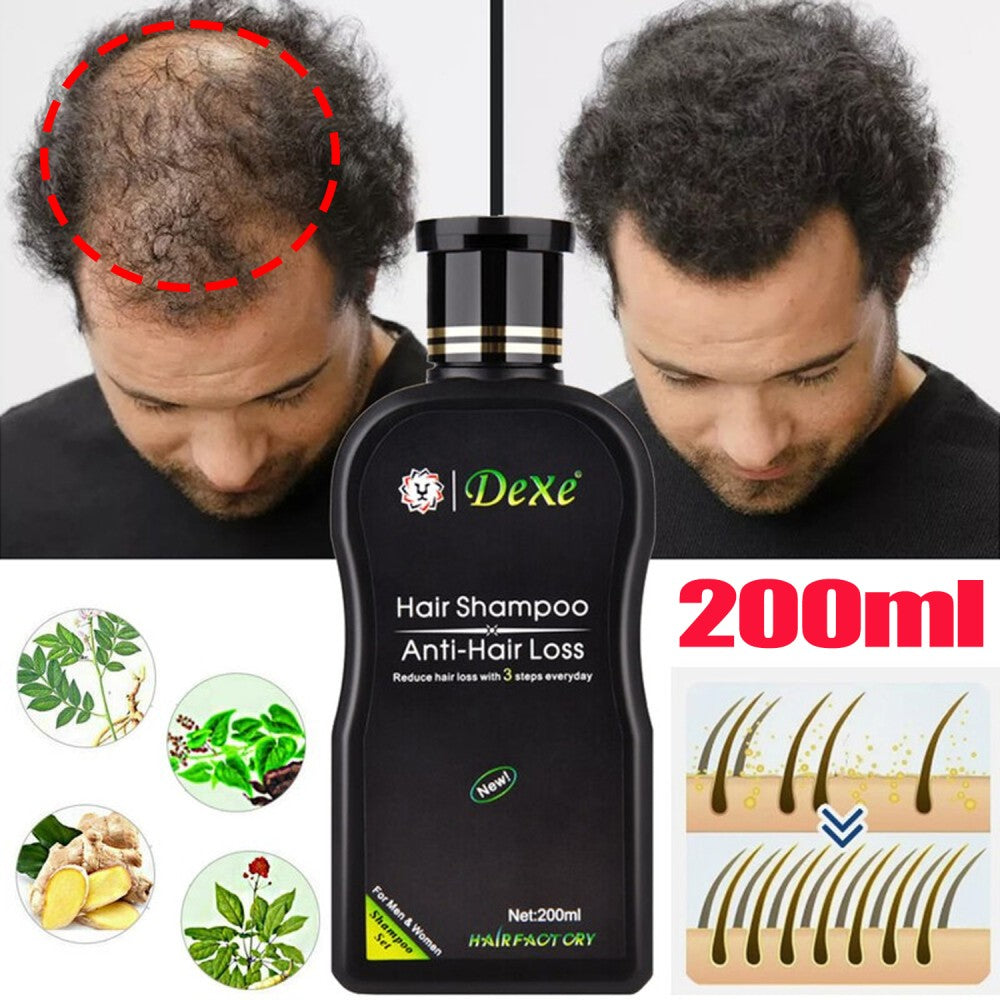 Anti-Hair Loss Shampoo 200ml - Herbal Daily Cleanser