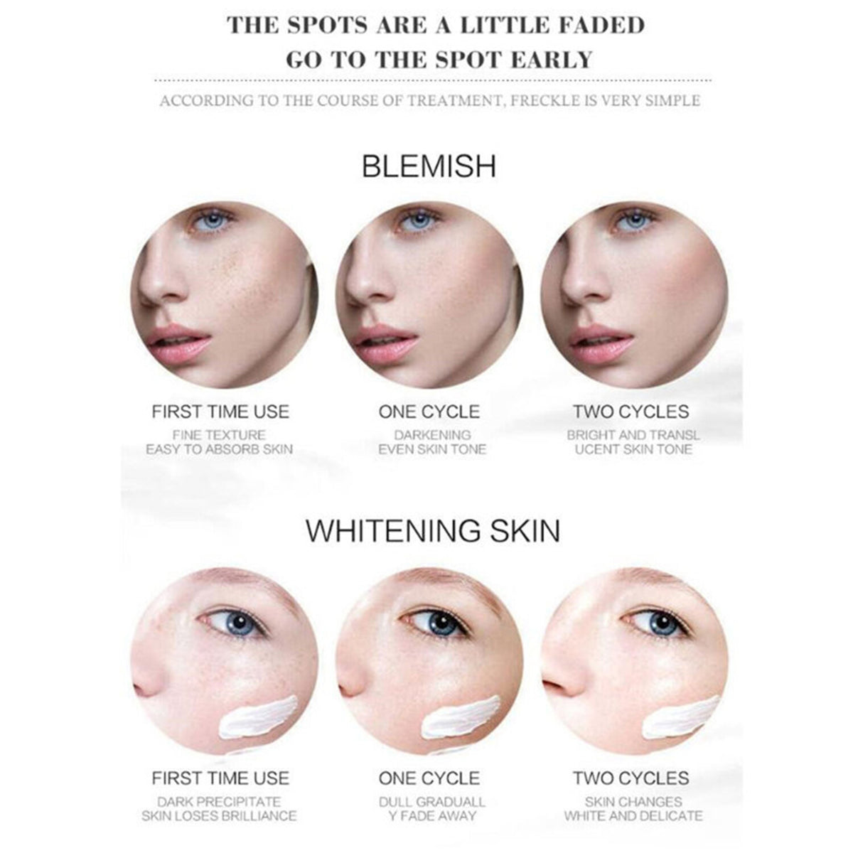 Whitening Freckle Cream for Melasma Acne Dark Spots 30ml - Skin Brightening Serum