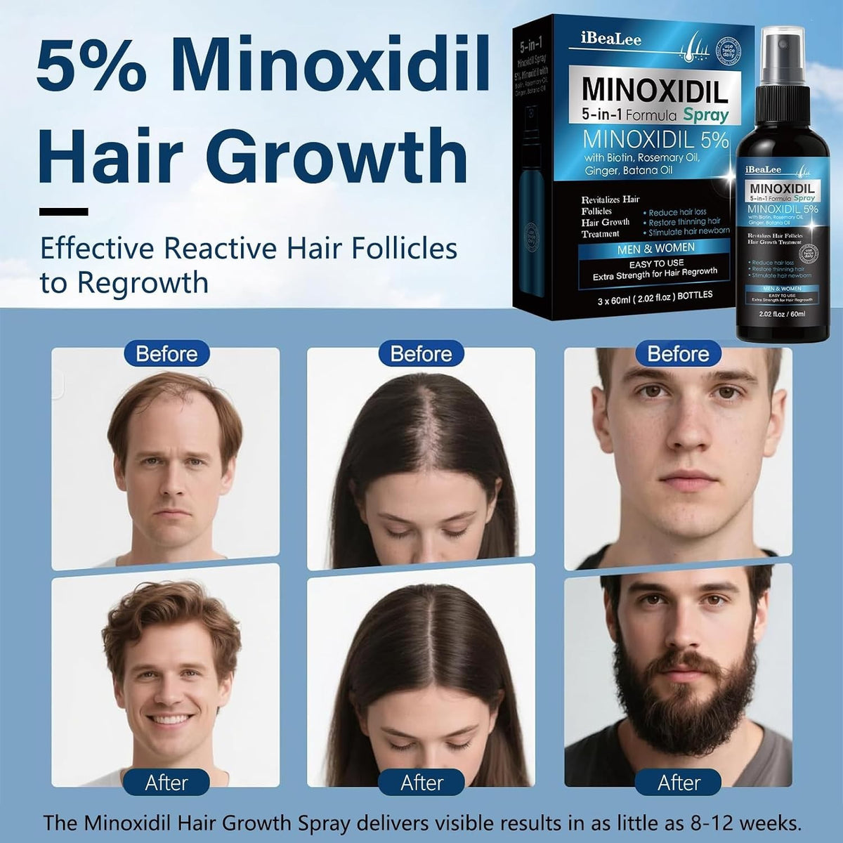 5% Minoxidil Hair Regrowth Spray for Men & Women - 3 Pack