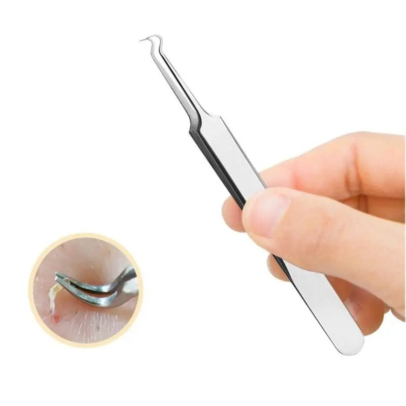 Blackhead Remover Tweezers - Curved Pimple & Acne Extraction Tool