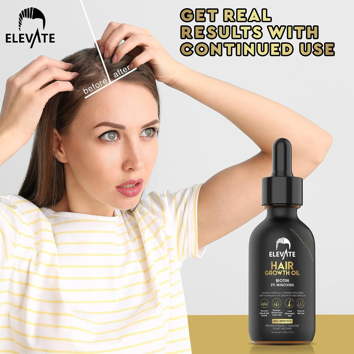 5% Minoxidil For Men and Women Hair Growth Serum, Regrowth Treatment
