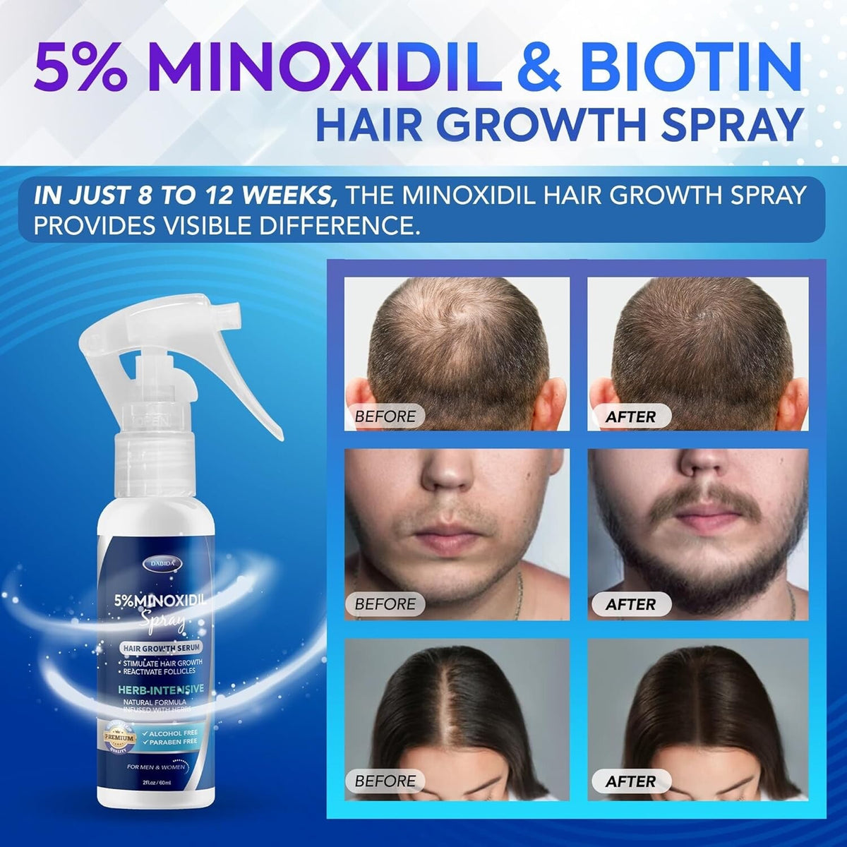 5% Minoxidil for Men Hair, Spray, Women Hair Growth