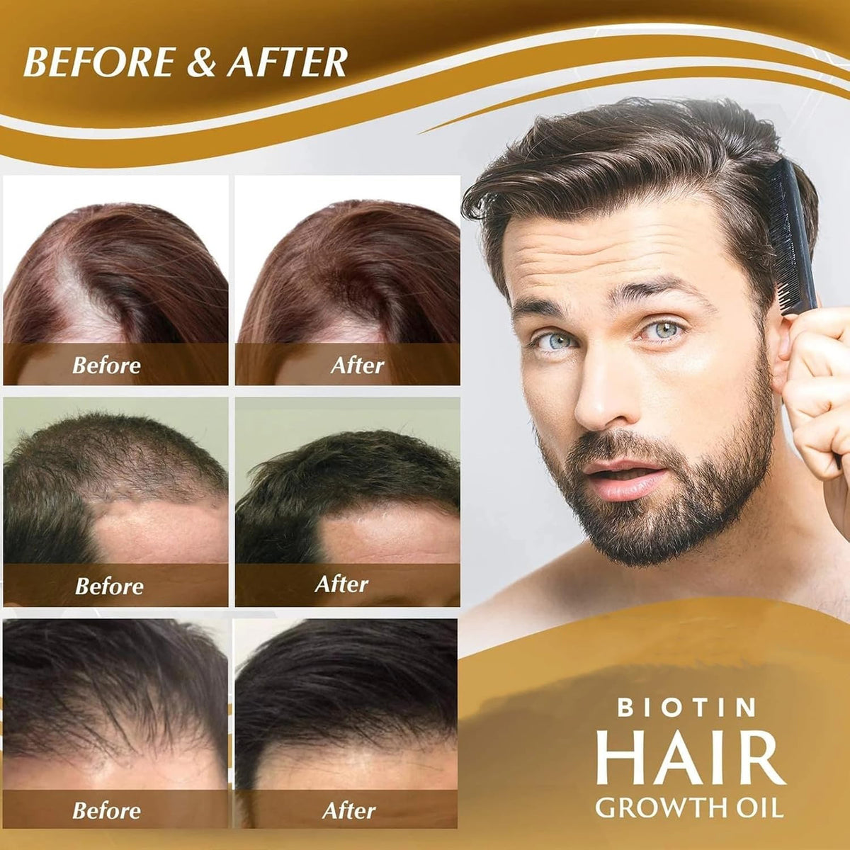 Biotin Hair Growth Serum, Spray, Ginseng Root Extract, Ginger