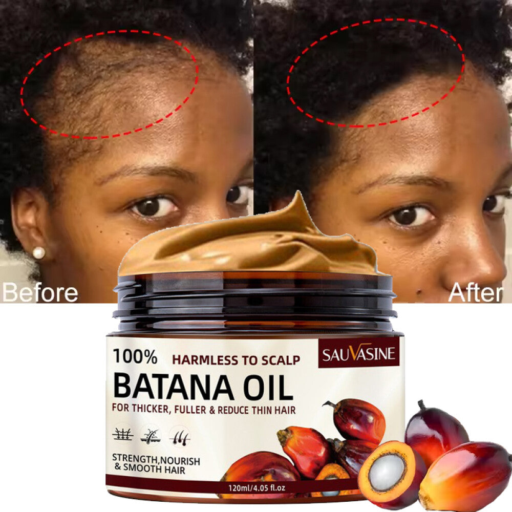 Hair Growth Treatment - 120ml Conditioner