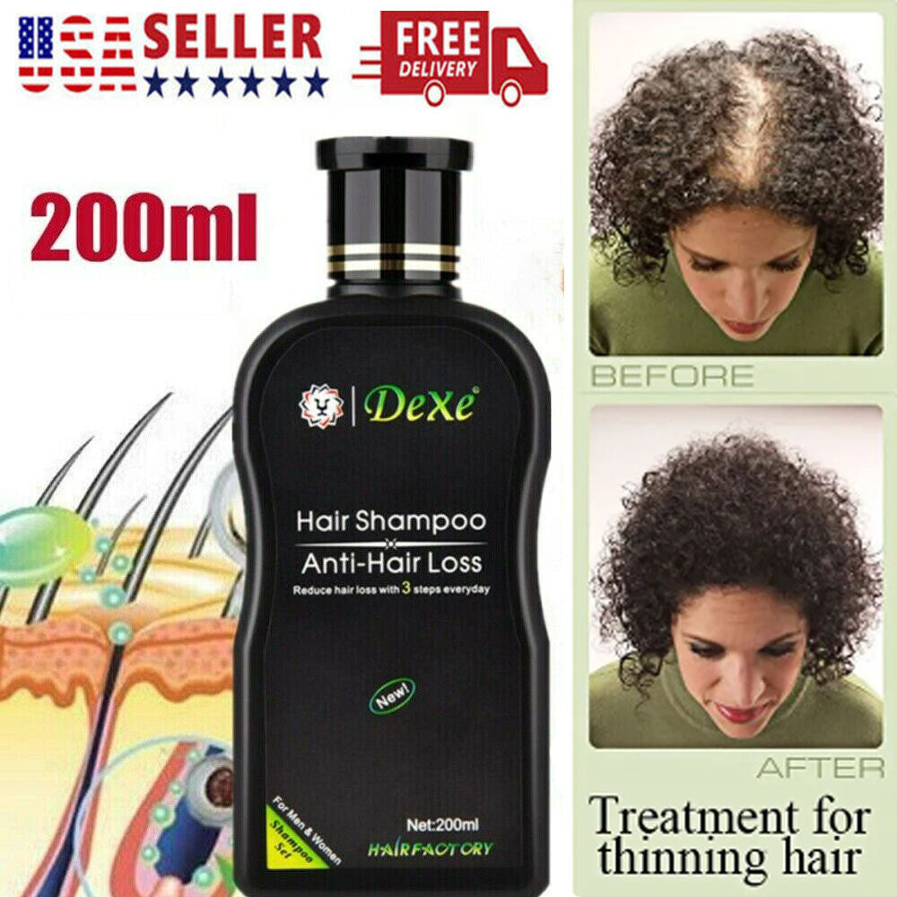Anti Hair Loss Shampoo - 200ml Herbal Regrowth Treatment
