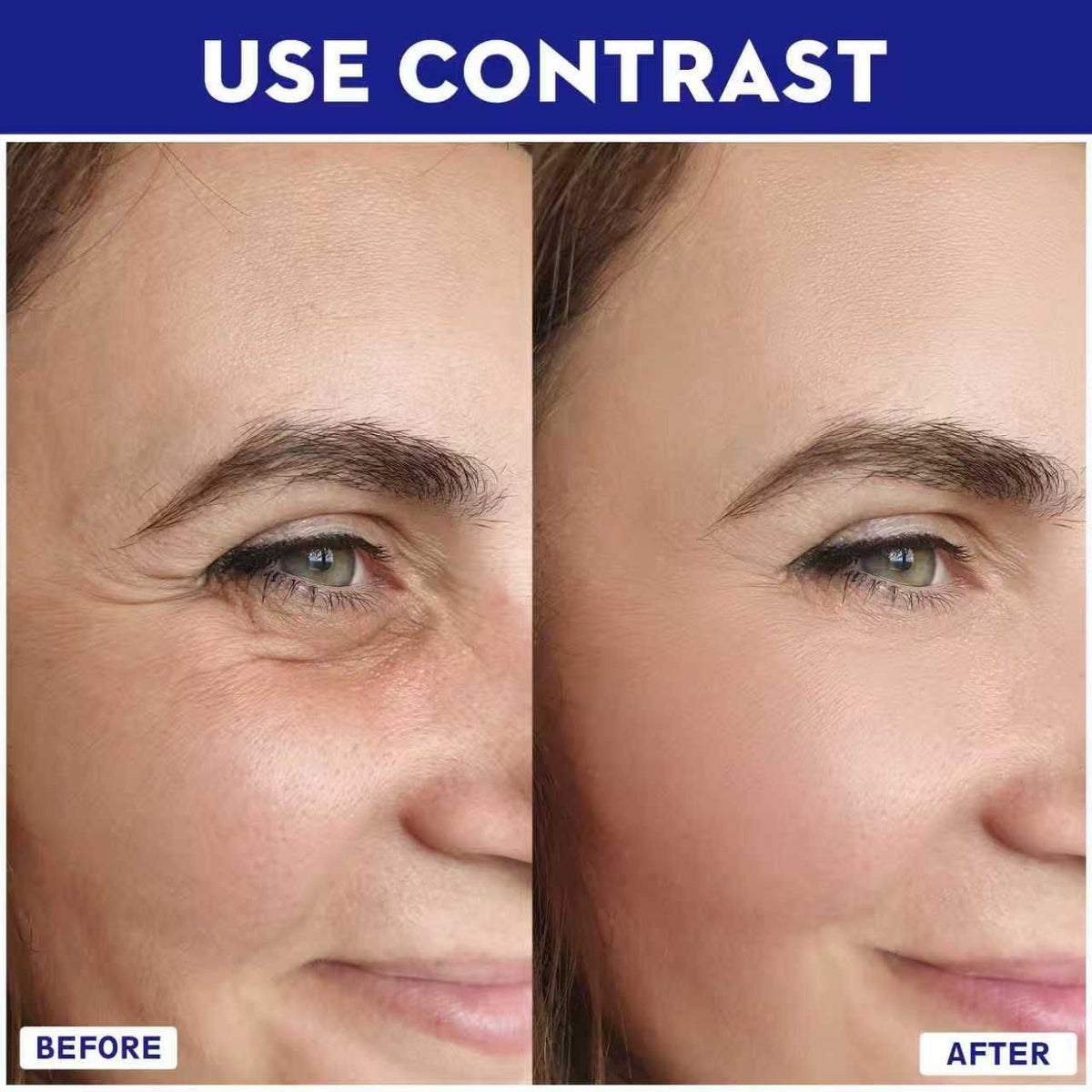 Anti-Aging Micro Infusion Device with Hyaluronic Acid Serum - 0.05mm Microneedle Skin Care System