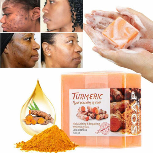 Turmeric & Ginger Natural Soap for Skin Brightening and Spot Removal - 100g