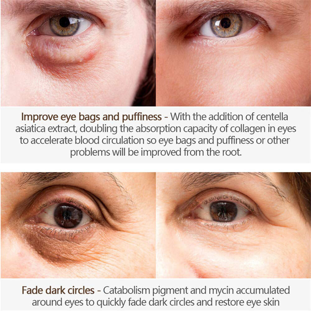 Anti-Aging Eye Cream Gel for Dark Circles & Bags - Brightening & Firming