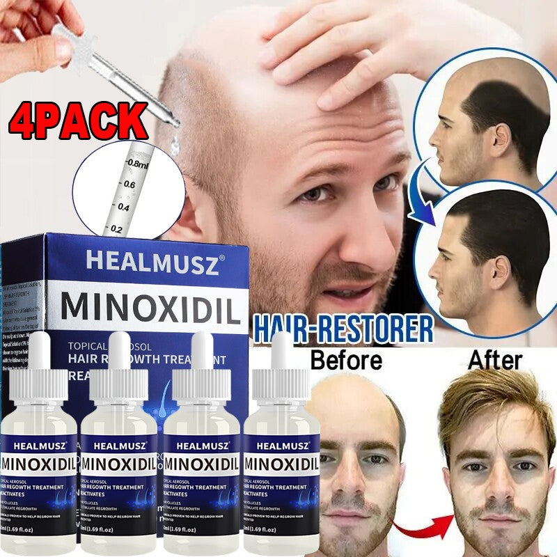 Minoxidil 5% Extra Strength Hair Regrowth Treatment for Men