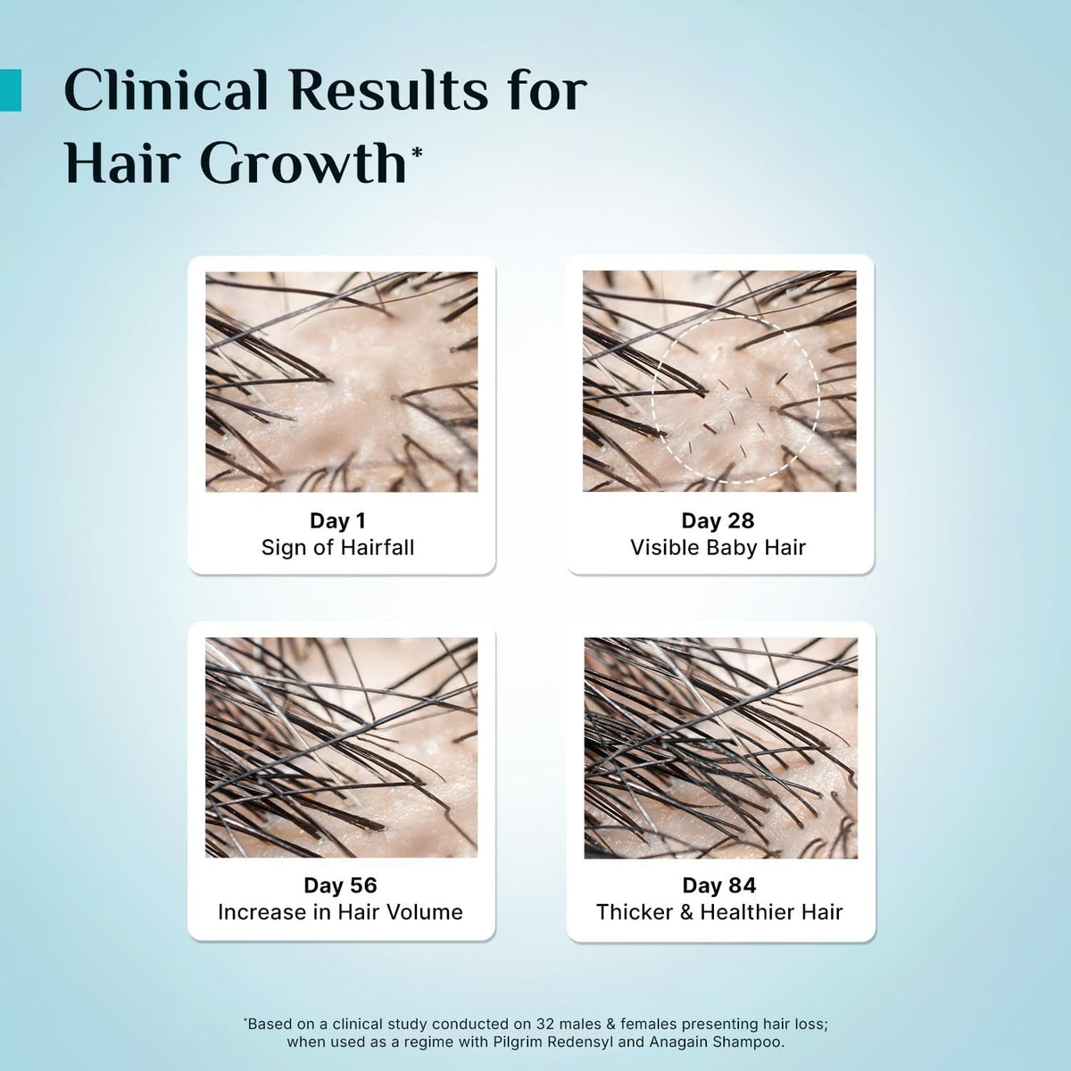 Revitalizing Hair Growth Serum with Redensyl - Thicker, Fuller in