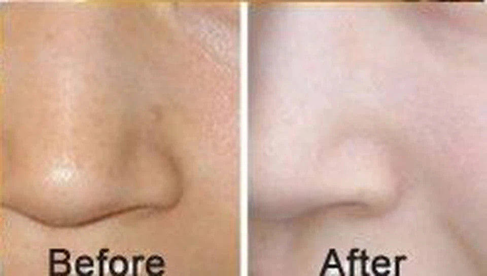 Gold Collagen Face Mask – 10 Pack Anti-Aging Hydrating