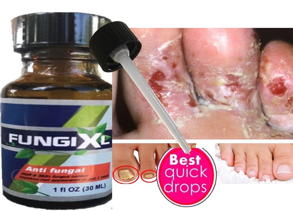 Antifungal Nail Treatment Solution for Toe & Fingernails