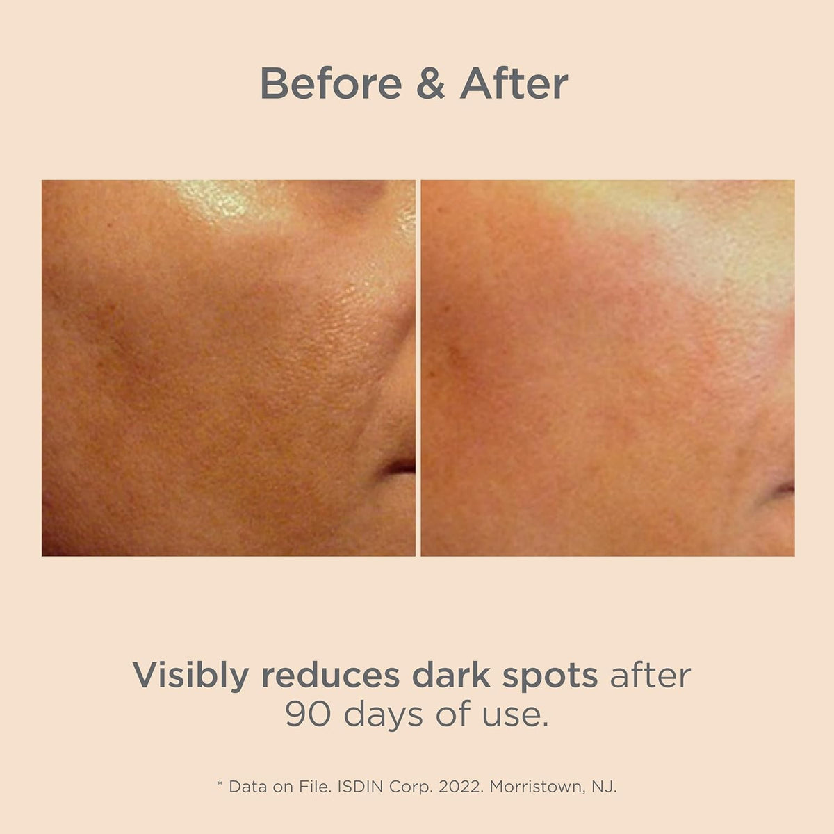 Isdin Melaclear Serum - Dark Spot Corrector 15ml