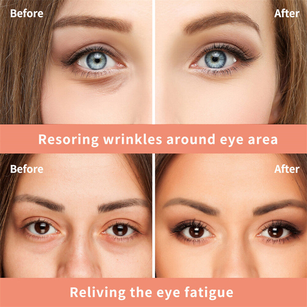 Anti-Age Eye Cream Set - 3 Pack Firming & Wrinkle Reduction for Eyes
